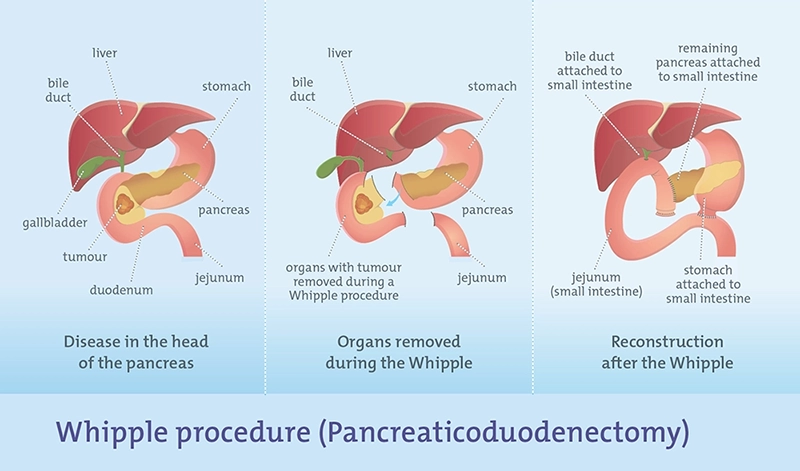diagram of the pancreas and surrounding organs