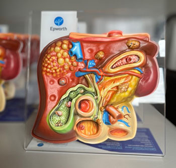 model pancreas